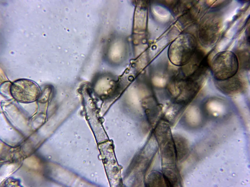 Botryobasidium conspersum 10 - Conidióforos